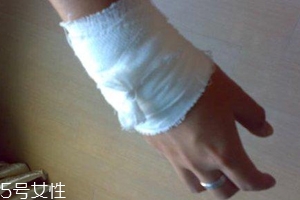 被蜈蚣咬傷后能治愈嗎？科學家有新發(fā)現(xiàn)