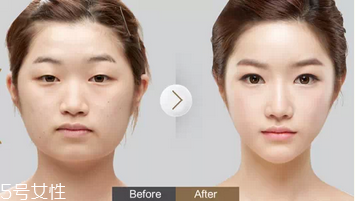 蕾絲雙眼皮貼好用嗎？蕾絲雙眼皮貼教程