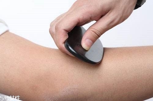 刮痧后胳膊疼是怎么回事 需警惕3種原因 刮痧后胳膊疼是怎么回事 需警惕3種原因