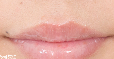 蘭芝唇膜吃進(jìn)去怎么辦？擁有水嫩嘴唇