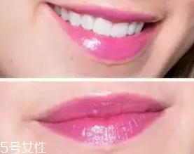 唇釉適合哪些人用？唇紋深的人