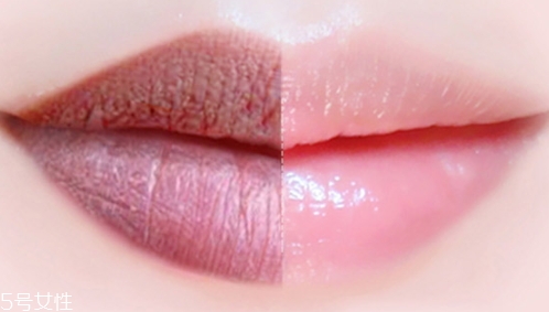 唇膏可以祛痘嗎？小心致痘風(fēng)險(xiǎn)