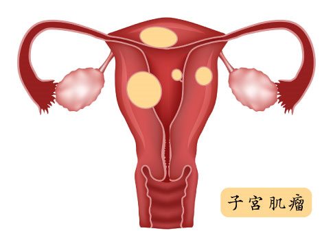 四物湯的功效與作用及食用方法 這些禁忌要注意 四物湯的功效與作用及食用方法 這些禁忌要注意