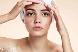 痘痘反復(fù)長(zhǎng)是什么原因？基礎(chǔ)護(hù)膚不夠用心
