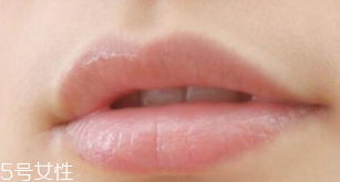 脫毛膏會(huì)不會(huì)使毛發(fā)更密？對毛發(fā)密度沒影響