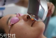 科技脫毛有哪些種類？冰點(diǎn)脫毛不毀毛囊