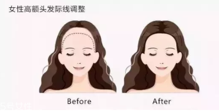 發(fā)際線粉填充和發(fā)際線筆哪個好？配合使用才最完美