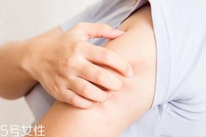 身體皮膚干燥用什么護膚品？這些身體乳拯救爆皮掉屑
