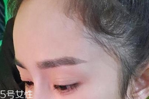 發(fā)際線高怎么治？拯救發(fā)際線攻略