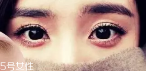 臥蠶和眼袋的區(qū)別是什么？臥蠶是肌肉眼袋是肥肉