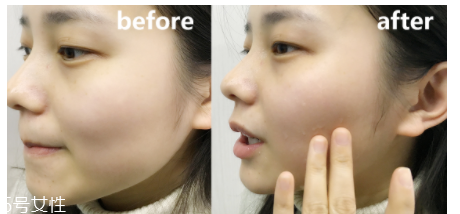 蘭蔻粉水適合什么年齡？只針對年輕肌底