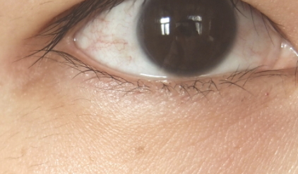 雅詩蘭黛適合敏感肌嗎？