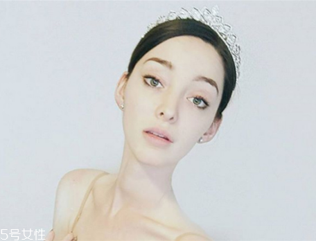 法令紋填充需要幾只玻尿酸？千萬(wàn)不可過(guò)量