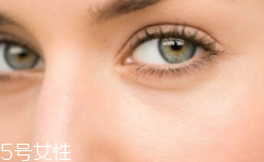 黑眼圈很重是什么原因？深扒三類黑眼圈的成因