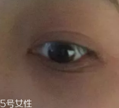 黑眼圈用什么眼霜好？多效護理型眼霜是首選