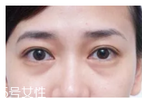 黑眼圈用什么眼霜好？多效護理型眼霜是首選