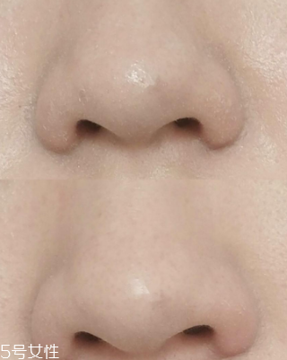 城野醫(yī)生收斂水可以每天用嗎？每天使用效果更佳