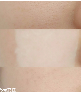 城野醫(yī)生收斂水可以每天用嗎？每天使用效果更佳