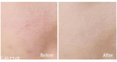 妮維雅小藍(lán)罐很油嗎？清爽不油膩