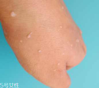 rosette去角質(zhì)凝膠怎么樣？真正的去角質(zhì)產(chǎn)品