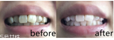 美白牙膏有用嗎？中華魔麗迅白牙膏評測