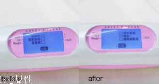 sk2神仙水適合油皮嗎？油皮親媽