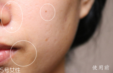 悅木之源和伊麗莎白雅頓哪個好？兩款精華大比拼