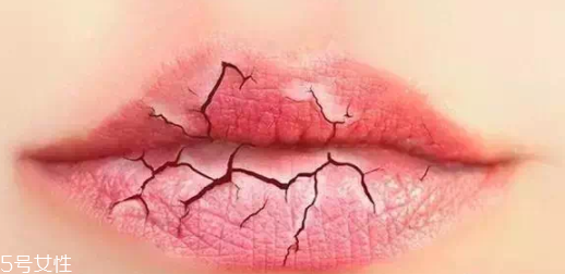 唇紋深適合什么口紅？別用啞光口紅