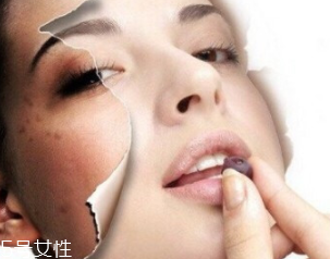 春季如何預(yù)防皮膚過(guò)敏？選擇敏感肌專用護(hù)膚品