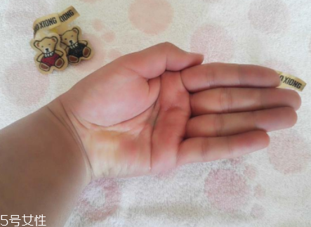 柳屋生發(fā)水有用嗎？一個(gè)月后長出新發(fā)