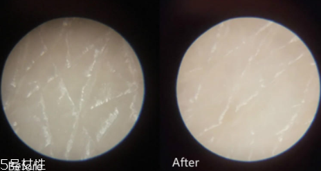 悅薇眼霜日本多少錢一瓶？悅薇眼霜日本專柜價(jià)