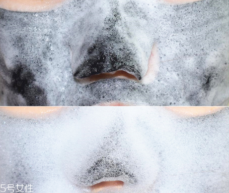 春雨泡泡面膜使用方法 敷完一定要用洗面奶清潔臉部 春雨泡泡面膜使用方法 敷完一定要用洗面奶清潔臉部