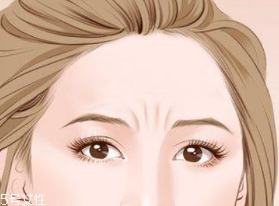 川字紋可以手術(shù)去除嗎？選擇手術(shù)需謹(jǐn)慎