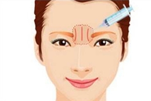 川字紋可以手術(shù)去除嗎？選擇手術(shù)需謹(jǐn)慎