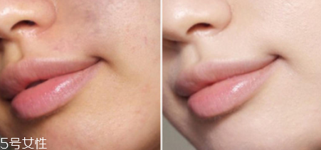 得鮮遮瑕液哪個色號好？1.5號色適合自然膚色