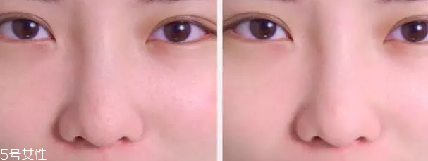 草莓鼻用什么產(chǎn)品最有效？4款產(chǎn)品讓鼻頭亮麗潔凈