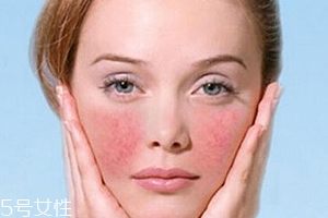 紅血絲用哪種護(hù)膚品？6款大牌全面對(duì)抗紅血絲