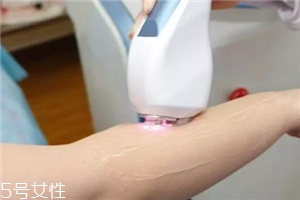 脫毛儀可以脫發(fā)際線嗎？脫了還會(huì)再長(zhǎng)