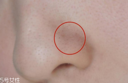 薇姿魔幻水怎么樣？薇姿水光煥亮角質調理液好用嗎？