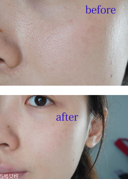 notime導(dǎo)入儀怎么樣？入門(mén)美容儀首選它