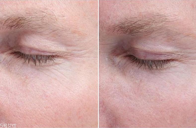 經(jīng)常熬夜用什么精華？3款實(shí)力派養(yǎng)出嫩膚新境界