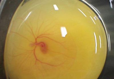 雞蛋里有血能吃嗎 雞蛋里有血絲是怎么回事 雞蛋里有血能吃嗎 雞蛋里有血絲是怎么回事