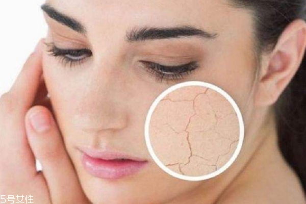 護(hù)膚水用了臉上刺痛怎么回事？這3點(diǎn)是關(guān)鍵