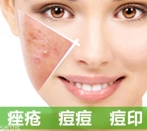 a酸是什么？a酸的功效與副作用