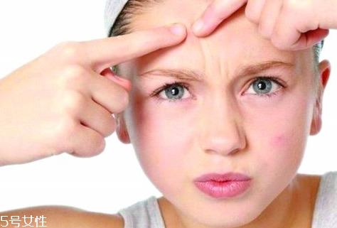 skinb5抗痘護(hù)膚片有效果嗎？