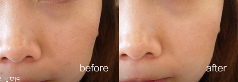 悅詩(shī)風(fēng)吟慕斯清潔面膜溫和嗎？干皮慎用