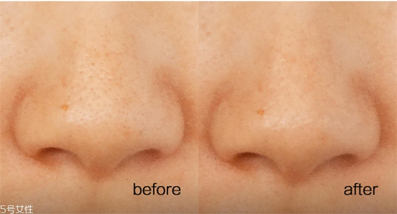 悅詩(shī)風(fēng)吟慕斯清潔面膜溫和嗎？干皮慎用