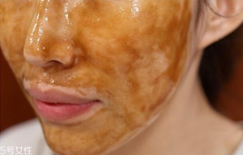 夏天油皮不能敷哪種面膜？這三種面膜越敷越油