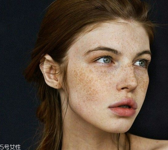 祛斑反彈是什么原因？一定沒注意這4點(diǎn)