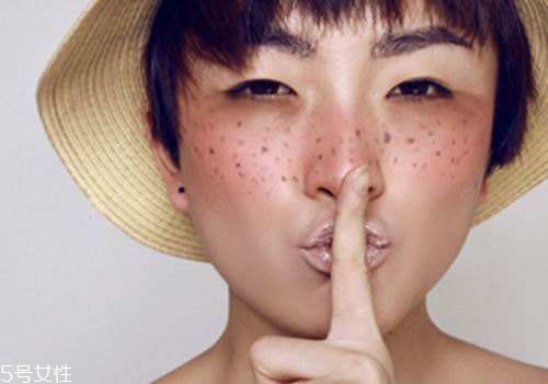 祛斑反彈是什么原因？一定沒注意這4點(diǎn)